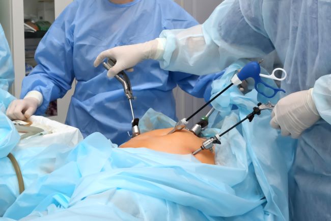 Gallbladder Surgery