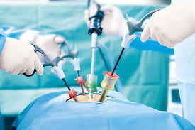 General Surgery