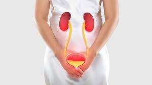 Urinary Tract Infections